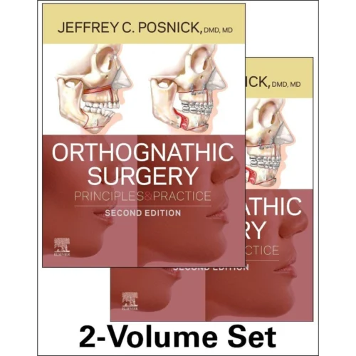 Orthognathic Surgery - 2 Volume Set: Principles and Practice