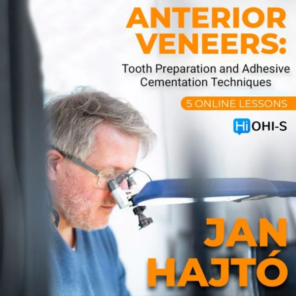 Anterior Veneer Tooth Preparation and Adhesive Cementation Techniques Anterior Veneer: Tooth Preparation and Adhesive Cementation Techniques