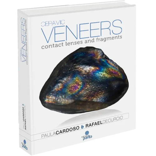 Ceramic veneers: contact lenses and fragments