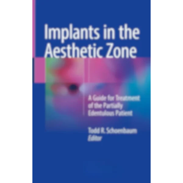 Implants in the Aesthetic Zone A Guide for Treatment of the Partially Edentulous Patient Implants in the Aesthetic Zone: A Guide for Treatment of the Partially Edentulous Patient