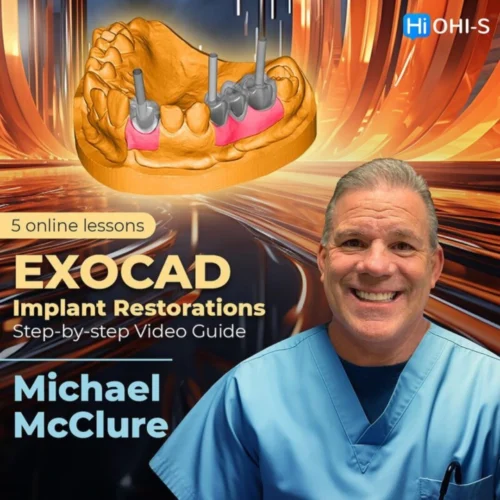 OHI-S EXOCAD Implant Restorations: Step-by-step Video Guide