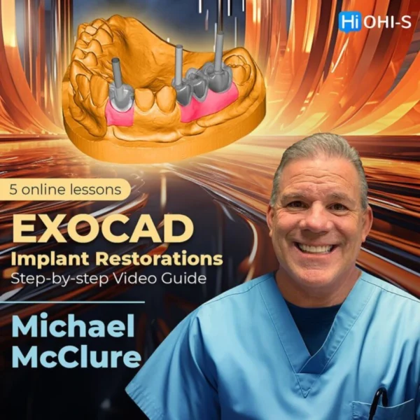 OHI-S EXOCAD Implant Restorations Step-by-step Video Guide OHI-S EXOCAD Implant Restorations: Step-by-step Video Guide