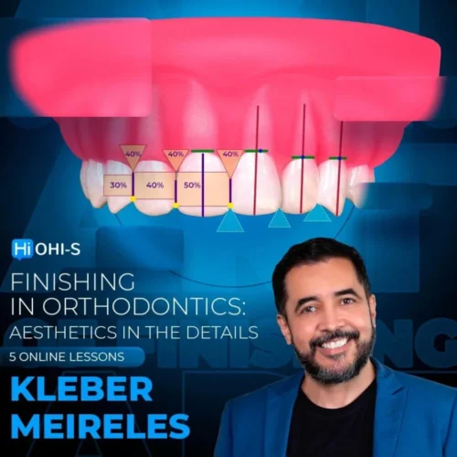 OHI-S Finishing in orthodontics: aesthetics in the details – Kleber Meireles