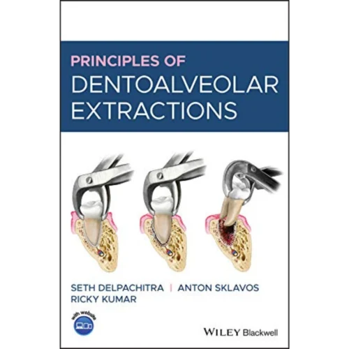 Principles of Dentoalveolar Extractions