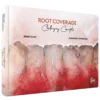 Root Coverage – Challenging Concepts