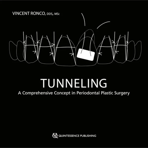 Tunneling A Comprehensive Concept in Periodontal Plastic Surgery Tunneling: A Comprehensive Concept in Periodontal Plastic Surgery