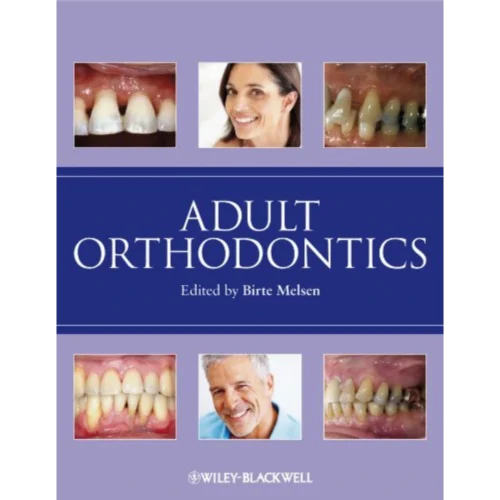 Adult Orthodontics
