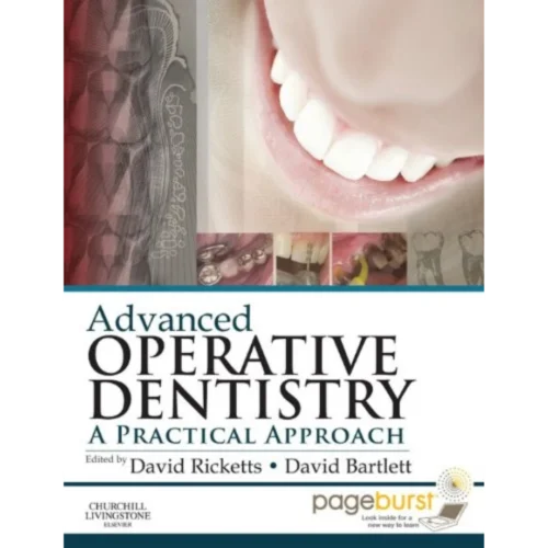 Advanced Operative Dentistry