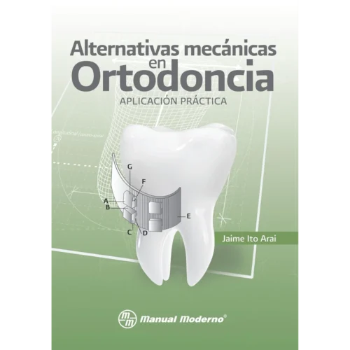 Alternativas mecánicas en ortodoncia. Aplicación práctica (Spanish Edition)
