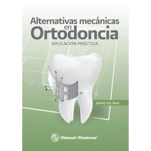 Alternativas mecánicas en ortodoncia. Aplicación práctica (Spanish Edition) Alternativas mecánicas en ortodoncia. Aplicación práctica (Spanish Edition)