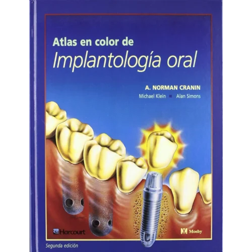 Atlas de Implantología oral (Spanish Edition)