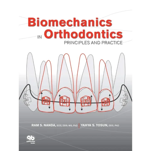 Biomechanics in Orthodontics