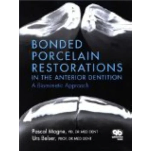 Bonded Porcelain Restorations in the Anterior Dentition