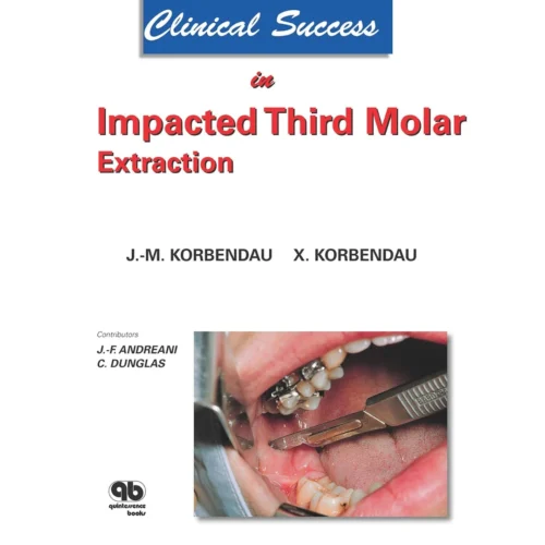 Clinical Success in Impacted Third Molar Extraction