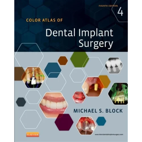 Color Atlas of Dental Implant Surgery