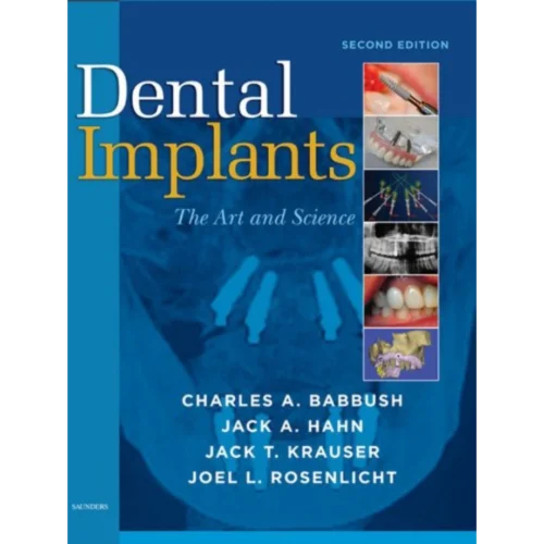 Dental Implants: The Art and Science