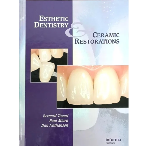 Esthetic Dentistry and Ceramic Restoration