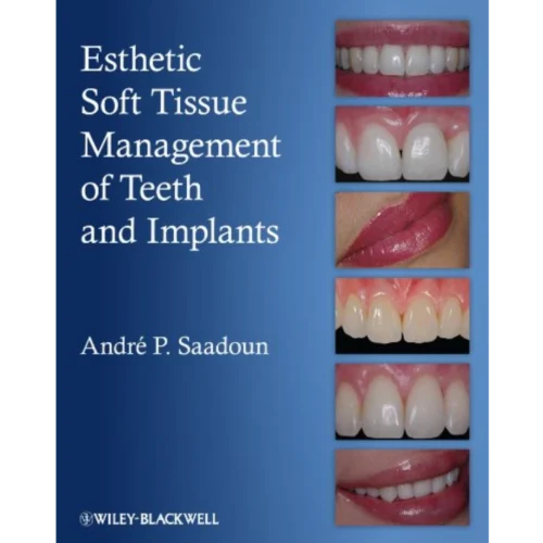 Esthetic Soft Tissue Management of Teeth and Implants