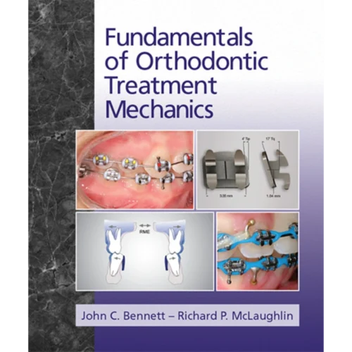 Fundamentals of Orthodontic Treatment Mechanics