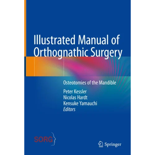Illustrated Manual of Orthognathic Surgery: Osteotomies of the Mandible
