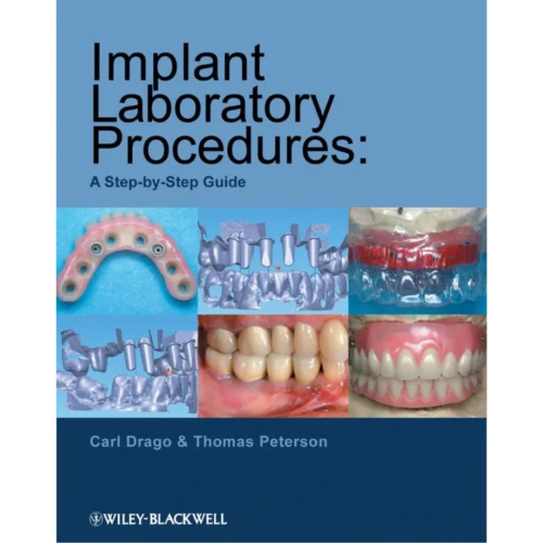 Implant Laboratory Procedures A Step-by-Step Guide