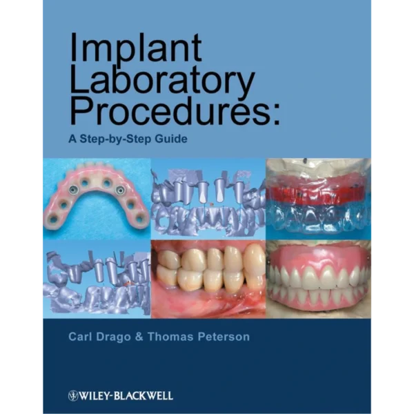 Implant Laboratory Procedures A Step-by-Step Guide Implant Laboratory Procedures A Step-by-Step Guide