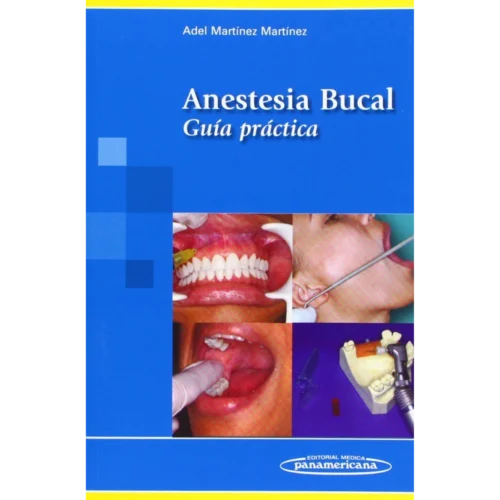 MARTINEZ:Anestesia Bucal. Gu a Pr ctica: Guía Práctica