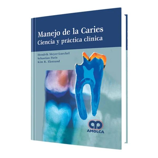 Manejo de la Caries - Ciencia y Práctica Clínica Manejo de la Caries - Ciencia y Práctica Clínica