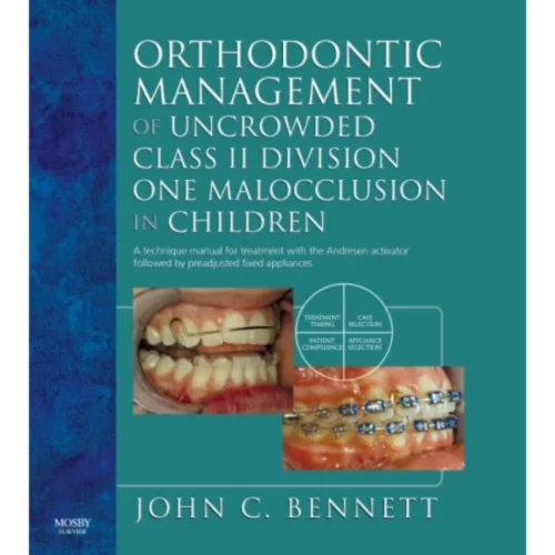 Orthodontic Management of Uncrowded Class II Division One Malocclusion in Children
