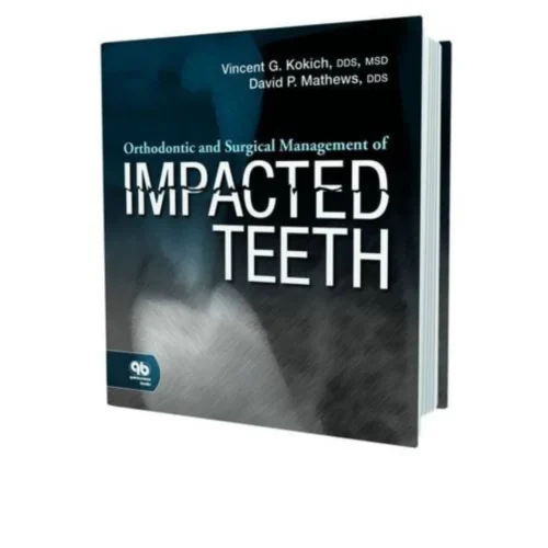 Orthodontic and Surgical Management of Impacted Teeth