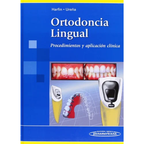 Ortodoncia Lingual Procedimientos y aplicación clínica (Spanish Edition)