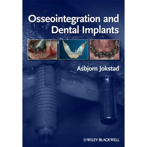Osseointegration and Dental Implants
