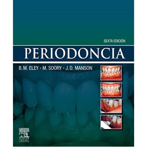 Periodoncia (Spanish Edition) Periodoncia (Spanish Edition)