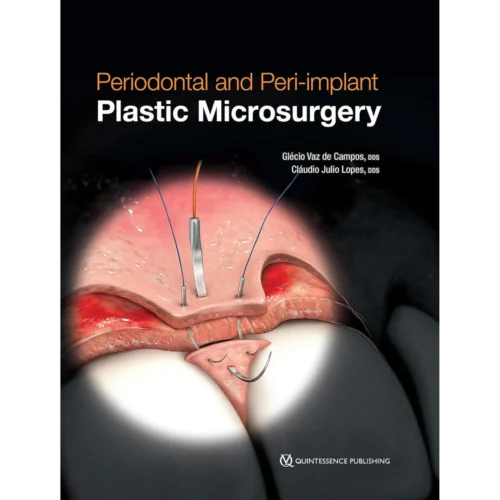 Periodontal and Peri-implant Plastic Microsurgery