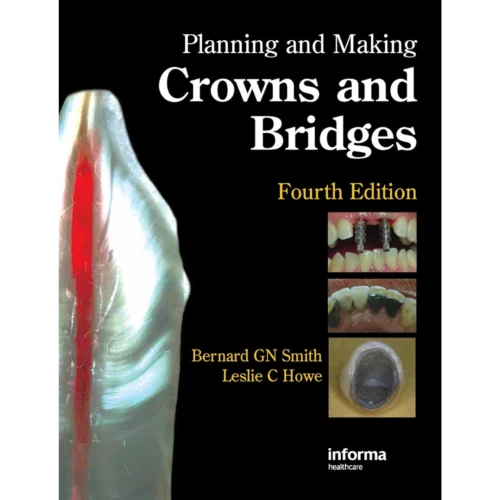 Planning and Making Crowns and Bridges