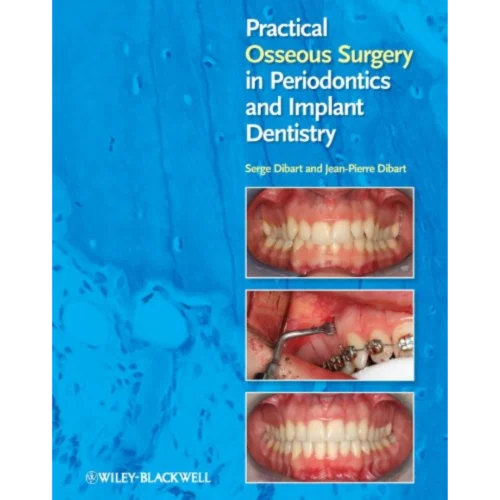 Practical Osseous Surgery in Periodontics and Implant Dentistry