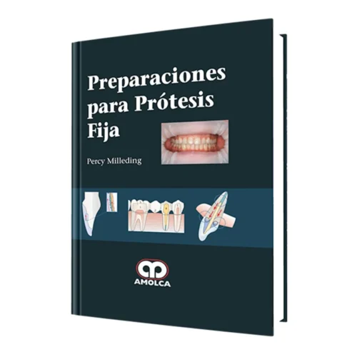 Preparaciones para prótesis fija (Spanish Edition)