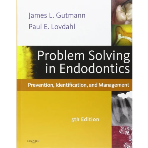 Problem Solving in Endodontics