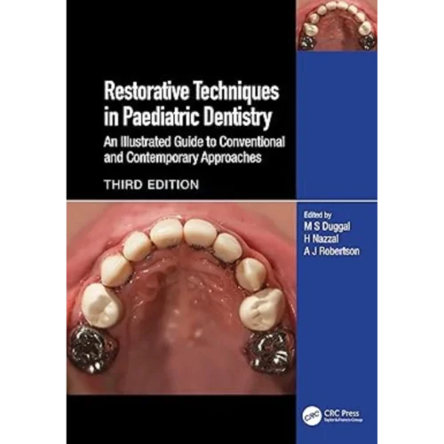 Restorative Techniques in Paediatric Dentistry