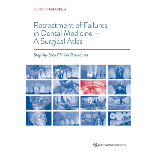 Retreatment of Failures in Dental Medicine: A Surgical Atlas: Step-by-Step Clinical Procedures