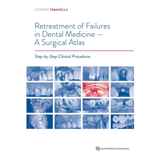 Retreatment of Failures in Dental Medicine A Surgical Atlas Retreatment of Failures in Dental Medicine: A Surgical Atlas: Step-by-Step Clinical Procedures