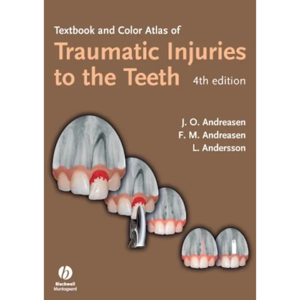 Textbook And Color Atlas Of Traumatic Injuries To The Teeth Textbook And Color Atlas Of Traumatic Injuries To The Teeth