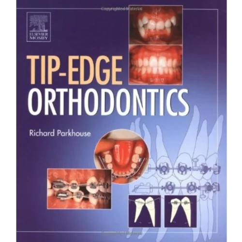 The Tip-Edge Orthodontic System
