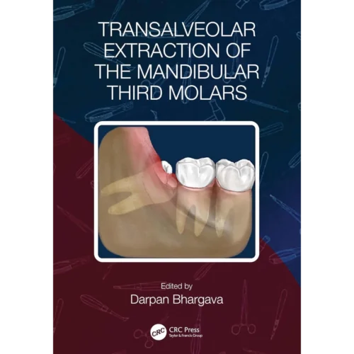 Transalveolar Extraction of the Mandibular Third Molars
