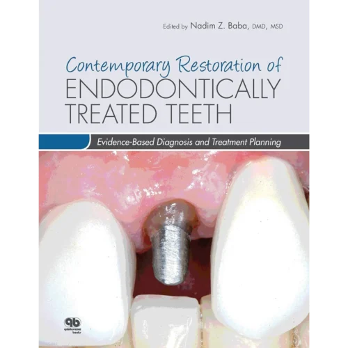 Contemporary Restoration of Endodontically Treated Teeth