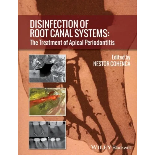 Disinfection of Root Canal Systems
