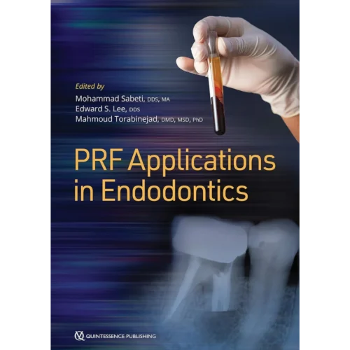 PRF Applications in Endodontics