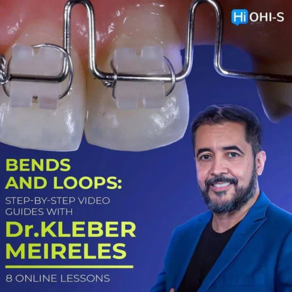 Bends and Loops Step-by-step Video Guides with Dr. Kleber Meireles Bends and Loops: Step-by-step Video Guides with Dr. Kleber Meireles