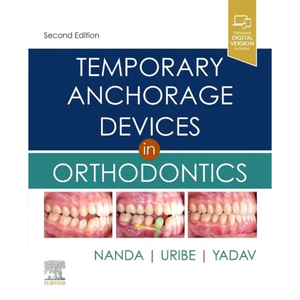 Temporary Anchorage Devices in Orthodontics 2nd Edition Temporary Anchorage Devices in Orthodontics 2nd Edition