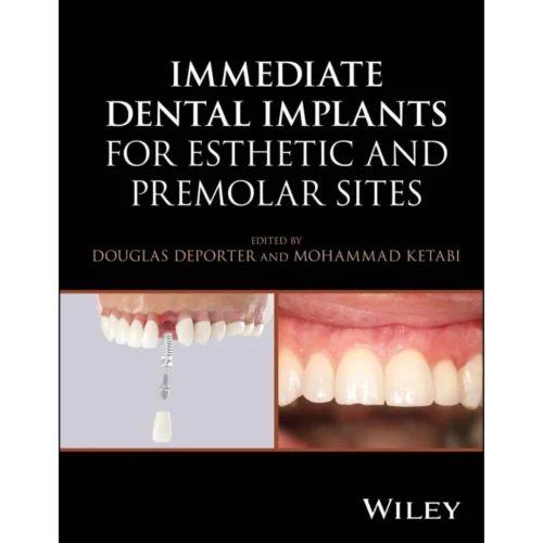 Immediate Dental Implants for Esthetic and Premolar Sites